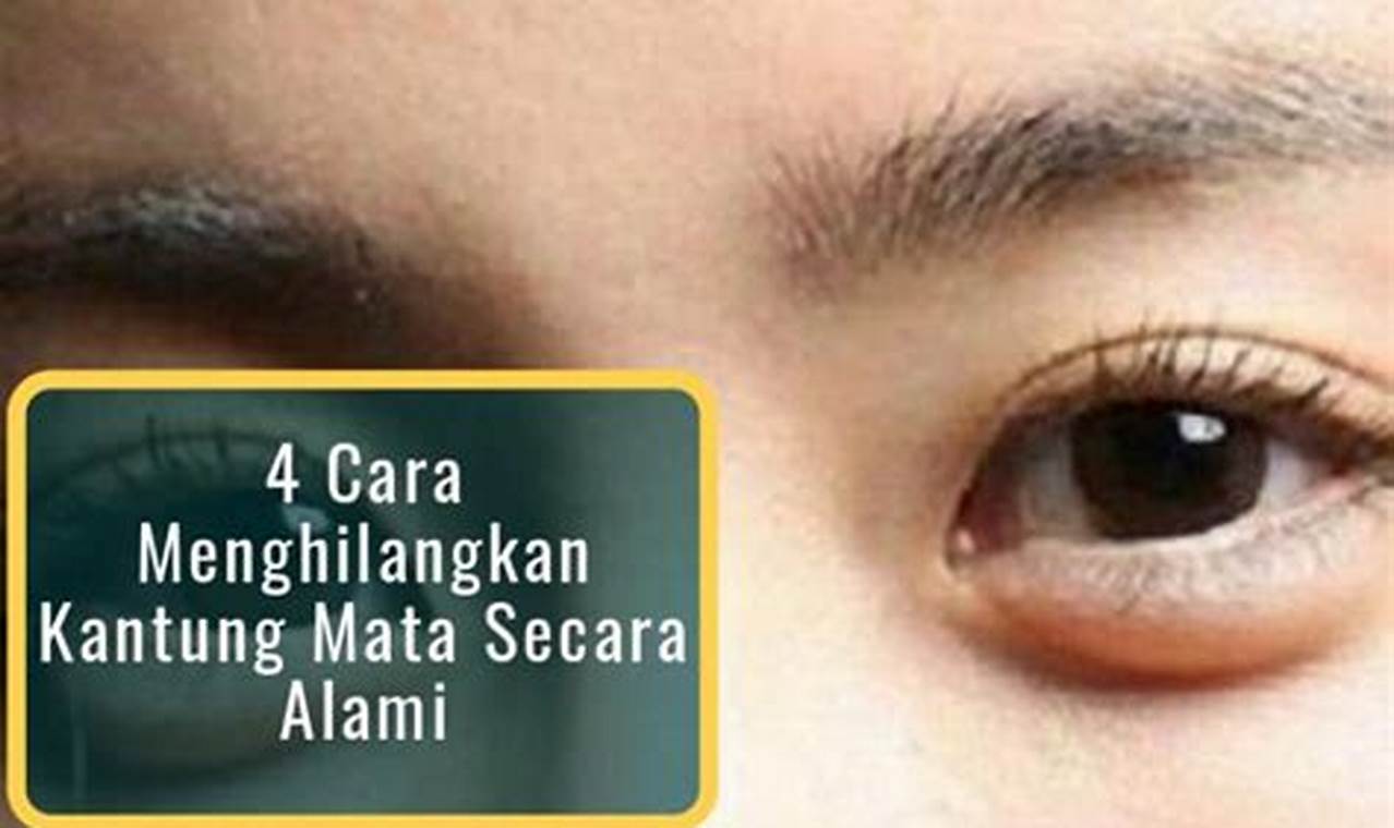 cara mengatasi kantung mata